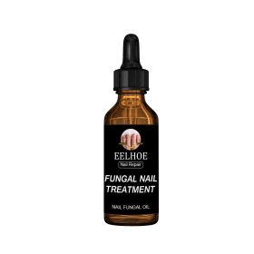 Onychomycosis Dead Skin And Repairing Lotion (option: 30ml)